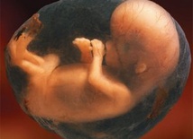 Obejrzeć płód przed aborcją