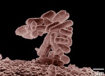 Bakterie coli w sieci wodnej szpitala 