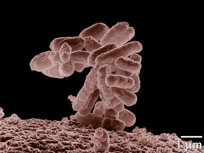 Hiszpania: Groźna bakteria zaatakowała