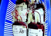 Dzisiejsza technologia pozwala na izolowanie komórek macierzystych szpiku z krwi dawcy. Warunkiem jest otrzymanie wcześniej specjalnych zastrzyków, które uruchomią proces uwalniania tych komórek do krwi obwodowej