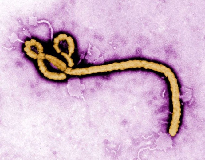 Wirus Ebola zaatakował w Ugandzie