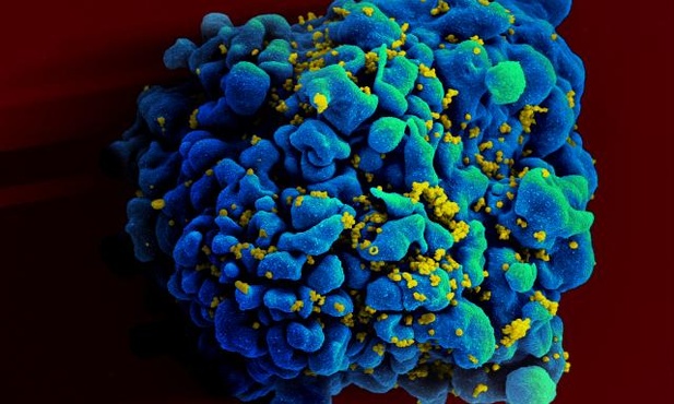 Odkryto szczególnie zjadliwy wariant wirusa HIV