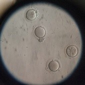 In vitro: Słaba alternatywa dla mrożenia dzieci