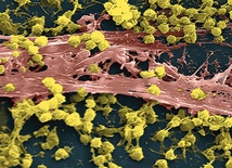 Te żółte kuleczki to komórki gronkowca złocistego odpornego na antybiotyki. Ta bakteria zabija więcej osób niż wirus HIV. Na zdjęciu z mikroskopu elektronowego jest powiększona ponad 2300 razy.