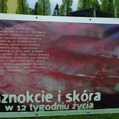  Nasi diecezjanie chętnie włączają się w inicjatywy promujące życie, np. wystawy, marsze i konferencje