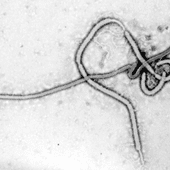 Czy Europie grozi epidemia wirusa Ebola?