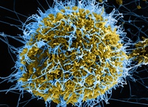 Przełom w leczeniu eboli