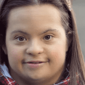 Francja: Zakaz publikacji uśmiechniętych buzi dzieci z zespołem Downa 