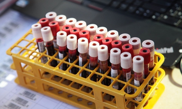 Badanie krwi może pomóc wcześniej rozpoznać 52 choroby