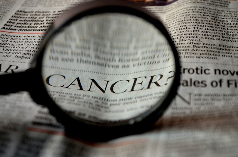 Stosowanie alternatywnych metod leczenia raka dwukrotnie zwiększa ryzyko zgonu