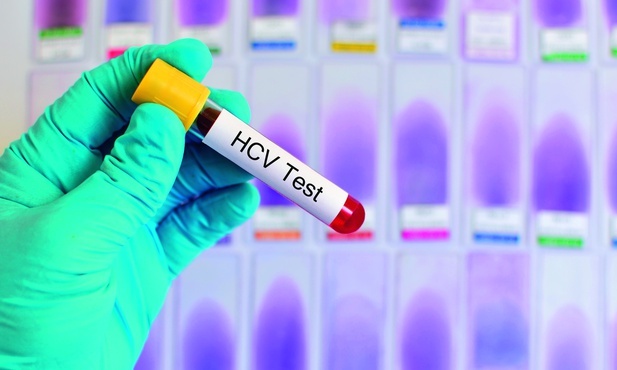HCV atakuje  po cichu