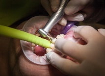 Radlin: stomatolog oszukiwał pacjentów i NFZ