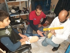 W 2020 roku Polska Misja Medyczna chce sfinansować kolejnych 20 protez dla dzieci w Syrii