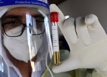 W Hiszpanii w ciągu doby 2031 zakażeń koronawirusem