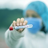 MZ: Najwięcej testów na wykrycie koronawirusa na Mazowszu - blisko 560 tys.