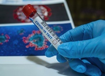 Potwierdzono pierwsze przypadki brytyjskiego wariantu koronawirusa w Hiszpanii