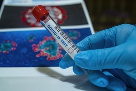 Analizowane są 23 zgony starszych osób po szczepieniach 