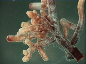 Strzępki Amanita muscaria, grzyba tworzącego ektomykoryzę