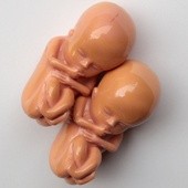 USA: Państwo sfinansuje badania na embrionach