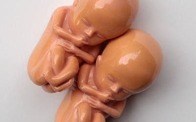 SLD zaczyna kampanię na rzecz aborcji na życzenie