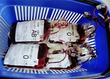 Śląsk: Apel o oddawanie krwi