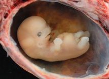 USA: Walka o życie ludzkich embrionów
