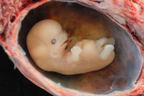 Ludzkie embriony do wyboru