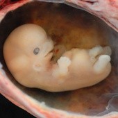Greenpeace jak Kościół w obronie embrionów!