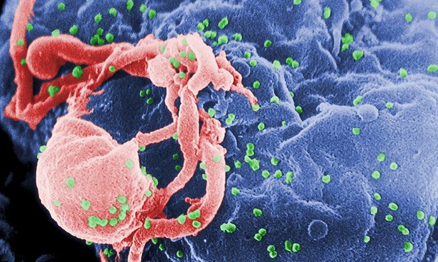 Do pomocy HIV