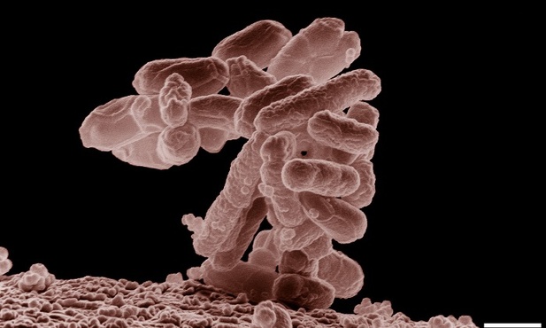 Nowy przypadek zakażenia E.coli w Polsce