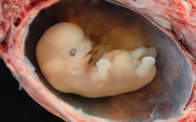 Francja: Badania na embrionach zabronione