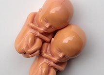 Kard. Parolin apeluje o ochronę embrionów