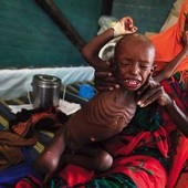 Somalijka i jej syn uciekli przed głodem do Kenii, do szpitala „Lekarzy bez Granic”
