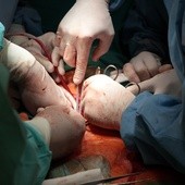 Pierwszy w Polsce przeszczep wątroby u pacjenta z HIV