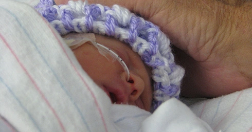 Moje bliźnięta syjamskie