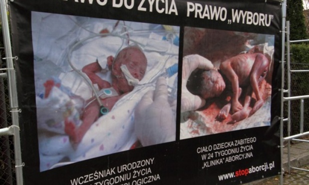 Nowe statystyki aborcji w Polsce