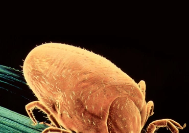 Borelioza z Lyme