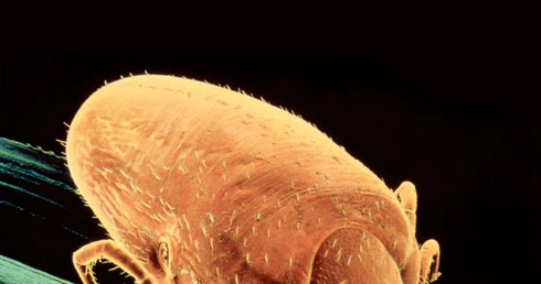 Borelioza z Lyme