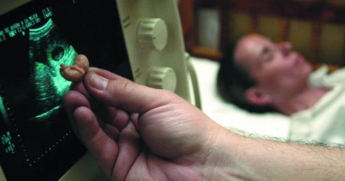 Zamieszki w czasie misterium