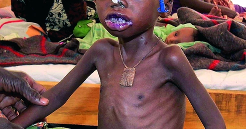 Głoduje połowa ludności