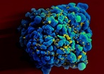 Nowe przeciwciało doskonale neutralizuje HIV