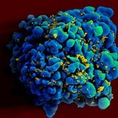 Drugi przypadek wyleczenia zakażenia wirusem HIV