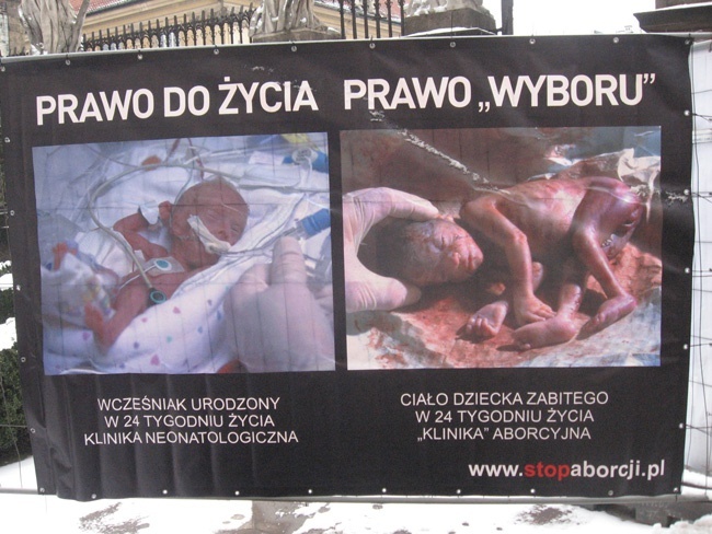 Wystawa antyaborcyjna "Wybierz życie" w Krakowie