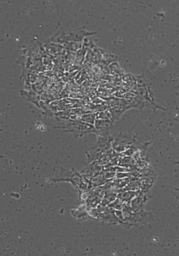 Komórki macierzyste - są alternatywy