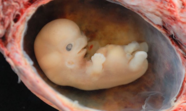 Nowa ustawa aborcyjna w Hiszpanii
