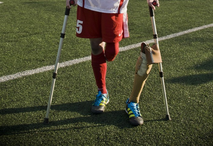 Austriacki piłkarz może grać w protezie