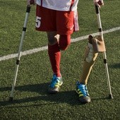 Austriacki piłkarz może grać w protezie