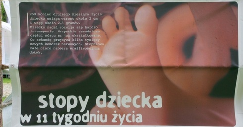 Zostań wolontariuszem i ocal abortowanych