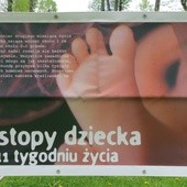 Zostań wolontariuszem i ocal abortowanych