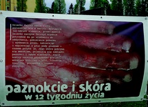  Nasi diecezjanie chętnie włączają się w inicjatywy promujące życie, np. wystawy, marsze i konferencje